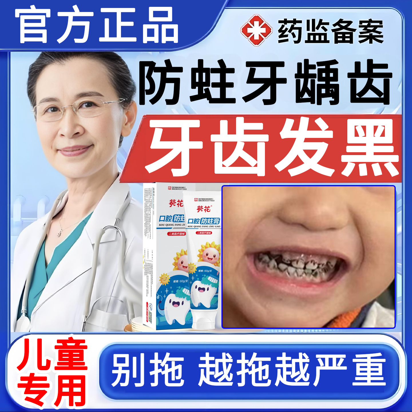 儿童牙齿黑斑色素沉淀去除牙膏防蛀牙龋齿修复蛀牙洞清理牙虫的药