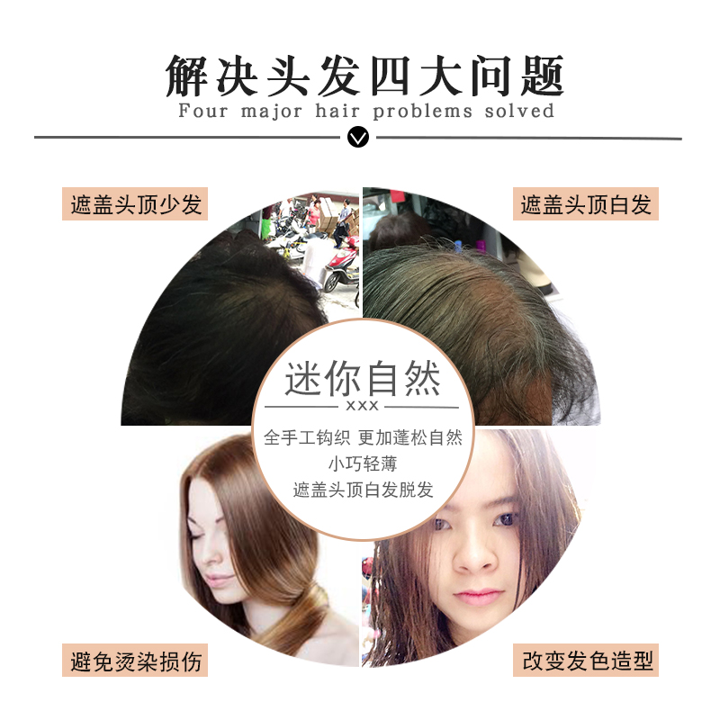 全真发假发片一片式 头顶补发片 无痕蓬松遮白发迷你头顶补发女