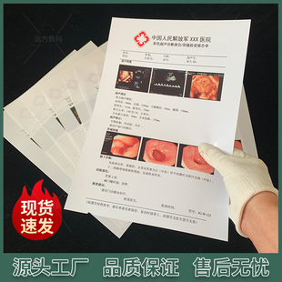 彩超胶片胃镜胶片三维重建胶片瓷白喷墨胶片彩超打印纸B超打印纸