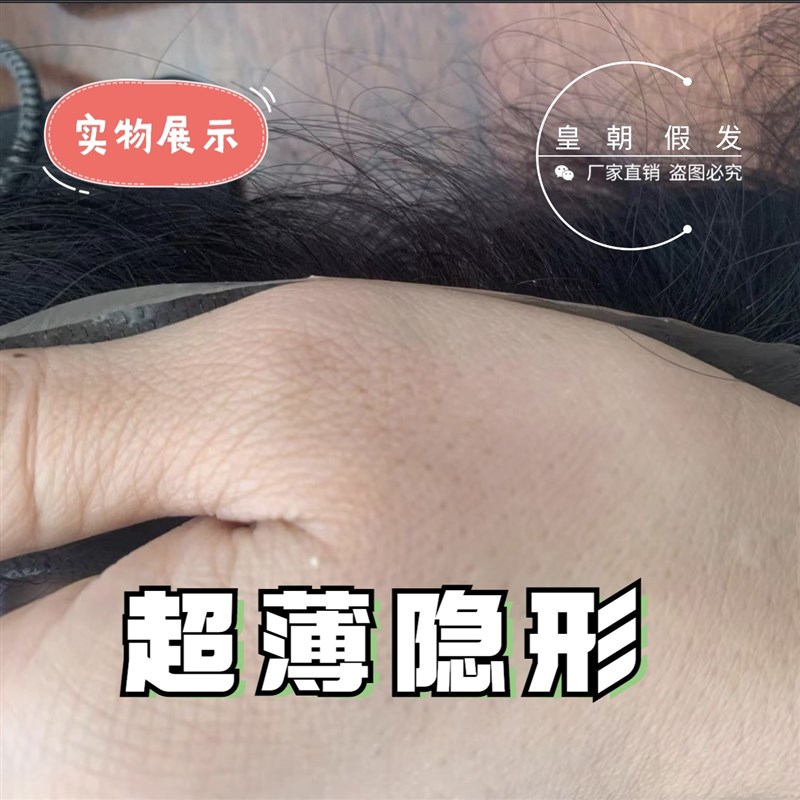 发际线贴自然隐形无痕刘海前额M型脱发补发男女通用假发生物头皮