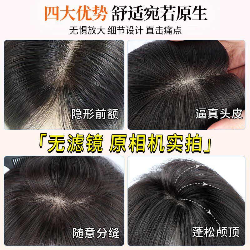 递针假发女片头顶补发蓬松全真发遮白发高颅顶自然前额无痕假发片
