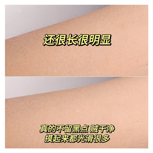 朵梦小圆点除毛刀刮毛刀腋毛腿毛女安全不伤肤无痛无黑点5层刀片