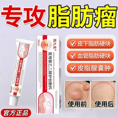陈九玄脂肪瘤消瘤膏皮下硬块