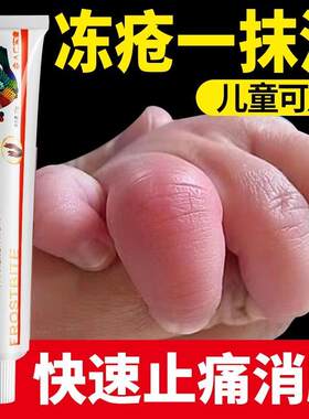 冻疮膏止痒消肿一抹消儿童蛇油护手脸部耳朵冻伤冻手防冻防裂霜苍
