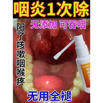 喉咙痒干咳嗽嗓子疼喷剂喷雾剂有痰异物感治疗嗓子疼的药润喉消炎