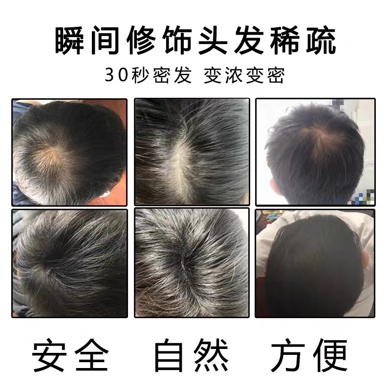 头发纤维粉增发男女士补发缝发际线 线粉填充喷雾加密发遮盖秃顶