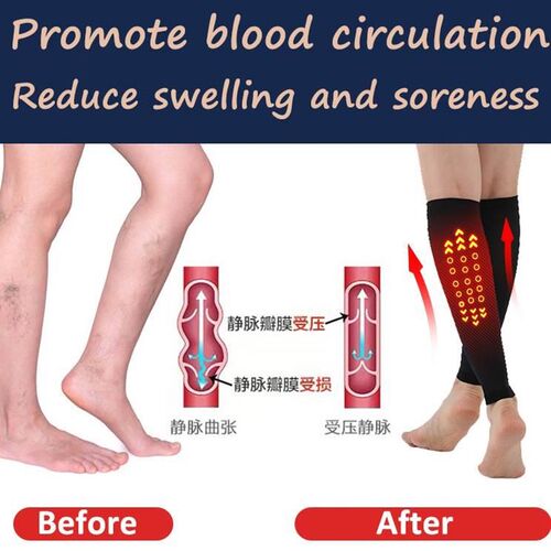1pair Compression Socks Prevent Calf Varicose Ve Soreness Wo