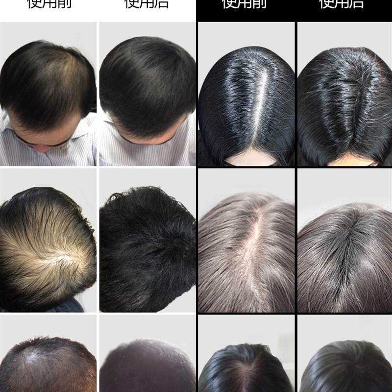 头发纤维粉发际线补发快速密发增发神器TOPPIK假发纤维美发粉遮盖