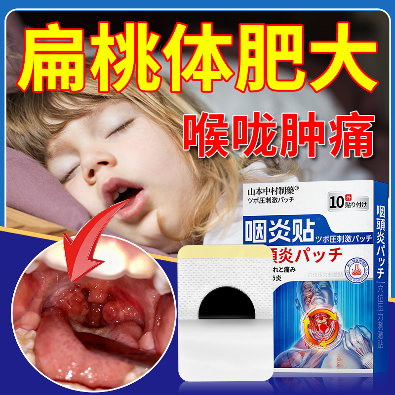 儿童扁桃体腺样体肥大肿大非中药贴治疗儿童睡觉打呼噜面容矫正器