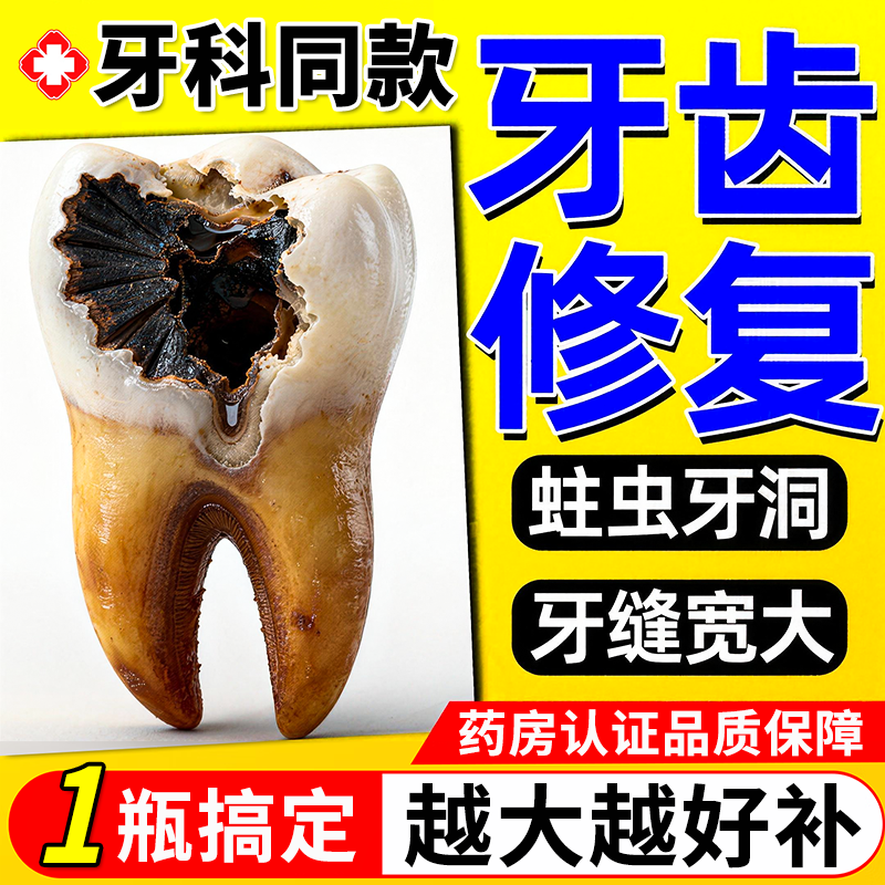 补牙材料永久医用神器补牙齿洞树脂膏修复液牙缝贴片自瓷粉己填充