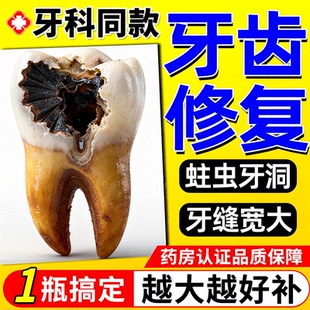 补牙材料永久医用神器补牙齿洞树脂膏修复液牙缝贴片自瓷粉己填充