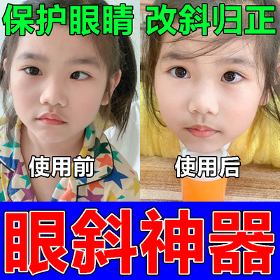斜视矫正器训练器聚散球纠正眼睛内外斜视弱视斗鸡眼歪矫正眼斜贴