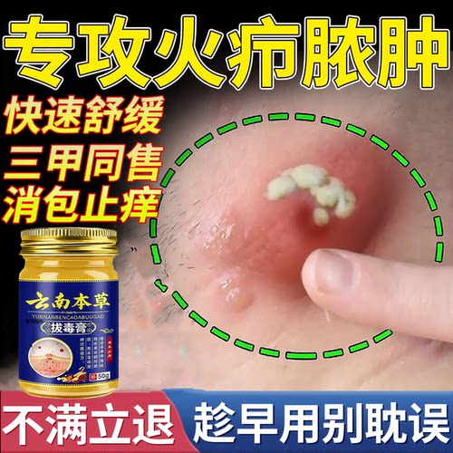 速消火疖子脓包降火消痒