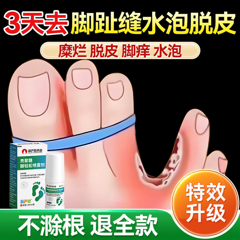 烂脚丫专用脚趾缝脱皮脚痒烂糜开裂水泡脚臭汗脚气去真菌感染喷剂