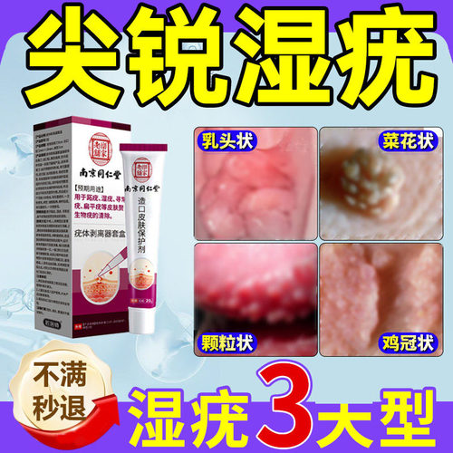 自然脱落湿疣无痛掉疣膏
