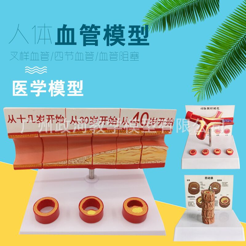 冠状动脉性 心血管动脉模型 硬化模型 老年心脏模型血栓教学模型