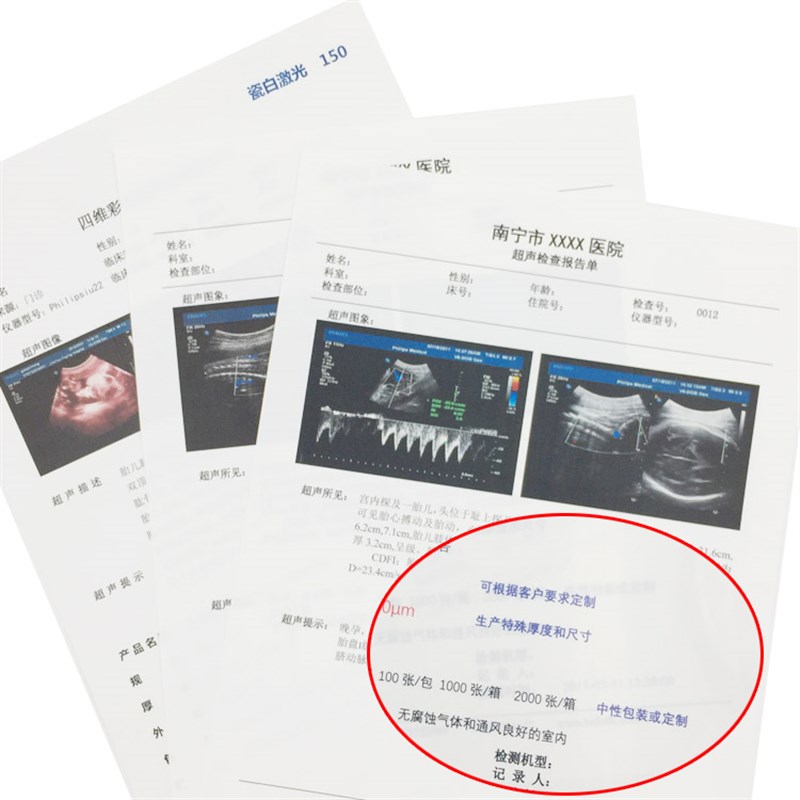 B超A4胃镜科室16K彩超 医用瓷白激光胶片双面打印 医院胶片纸 B5
