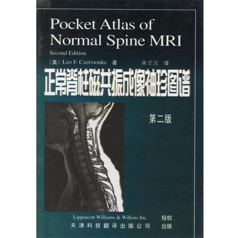 【正版书】 正常脊柱磁共振成像袖珍图谱 (美)兹尔威克 著,廉宗澂 译 天津科技翻译出版公司