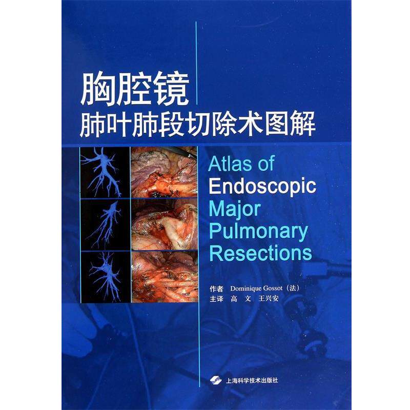 【正版书】 胸腔镜肺叶肺段切除术图解 (法)戈索 上海科学技术出版社