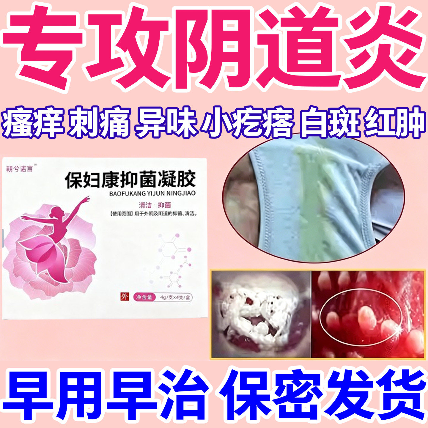 妇科凝胶阴道炎用药霉菌抑菌消炎保妇康妇科凝胶非白马女性私处痒