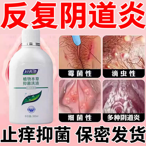 多种阴道炎外阴瘙痒尿道感染私处恶臭白带多