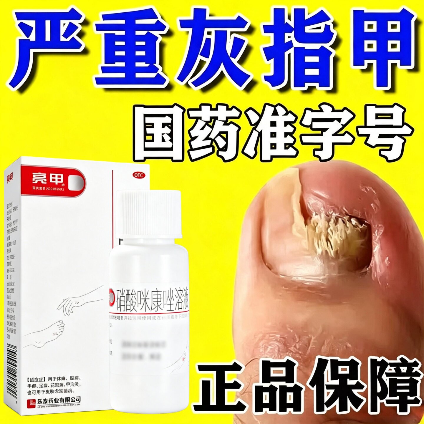 亮甲硝酸咪康唑溶液灰指甲专用药癣症