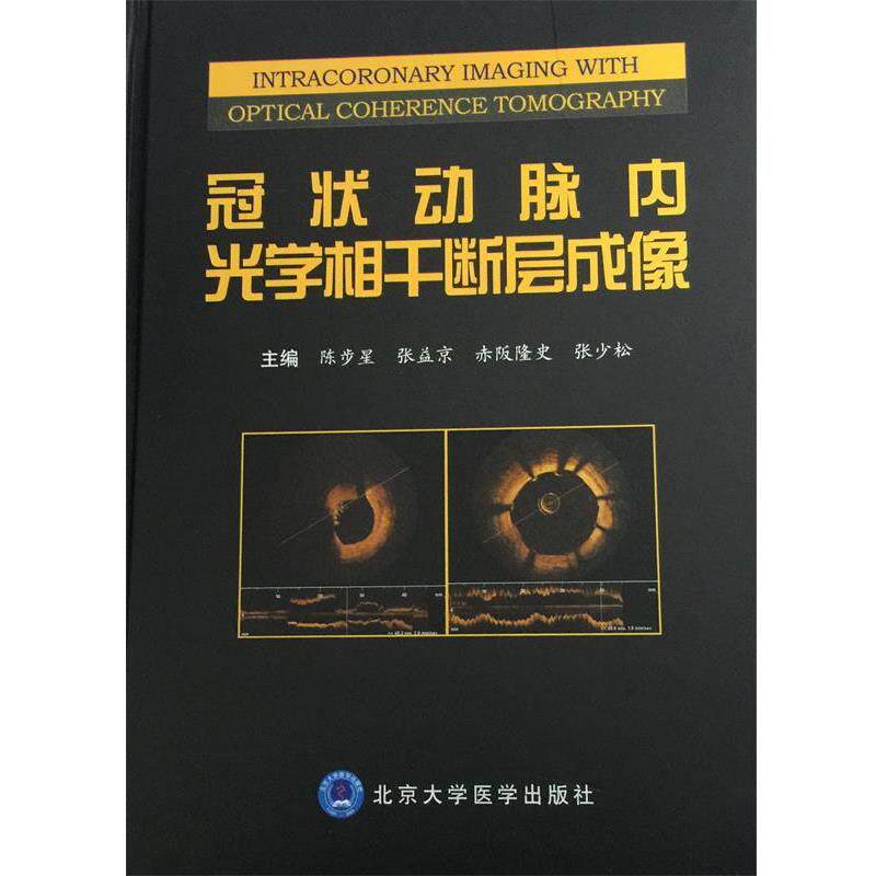 【正版书籍】 冠状动脉内光学相干断层成像 陈步星 等 北京大学医学出版社