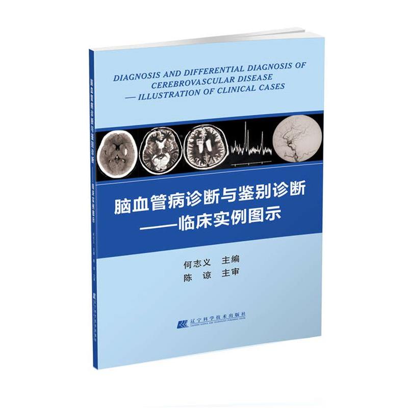 【正版书籍】 脑血管病诊断与鉴别诊断--临床实例图示 何志义 辽宁科学技术出版社