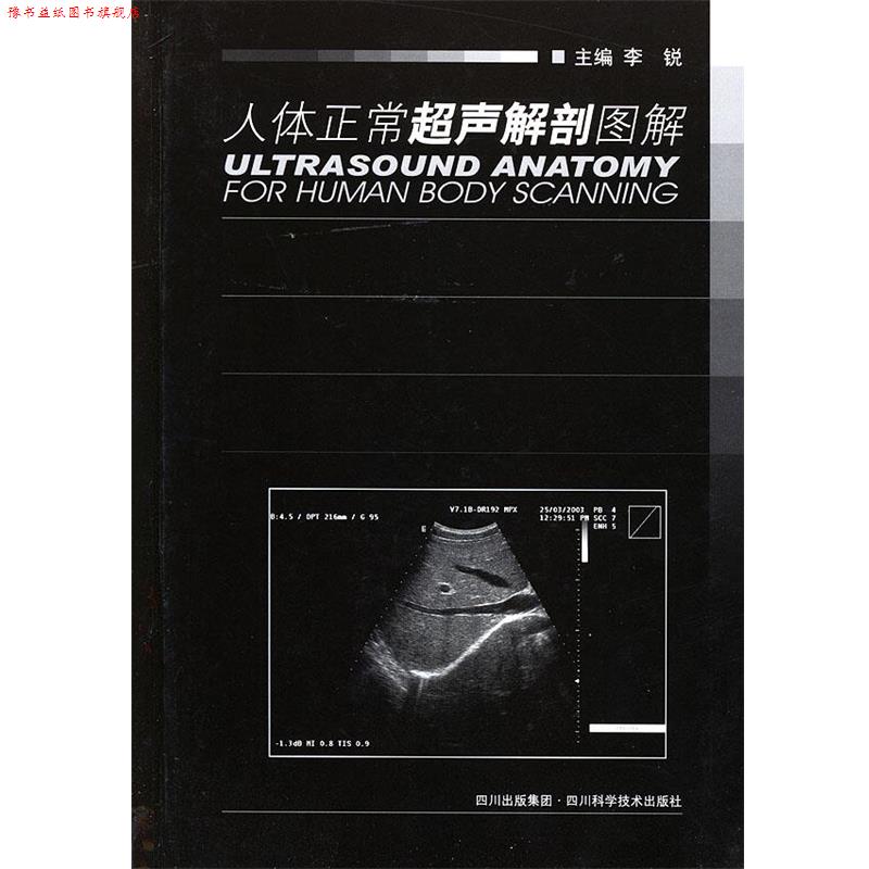 【正版书】 人体正常超声解剖图解 李锐 主编 四川科技出版社