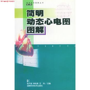 【正版书】 简明动态心电图图解 张开滋,钟杭美,王玮 湖南科学技术出版社
