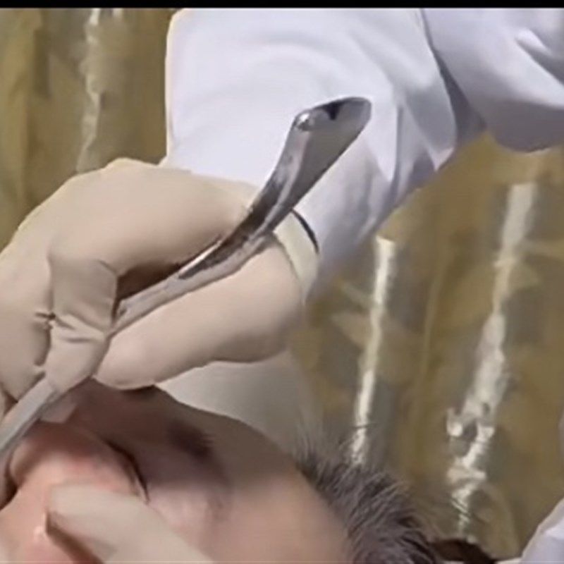 316不锈钢筋膜刀勾子刀按摩棒刮痧板深层肌肉理疗胸锁骨松解刀