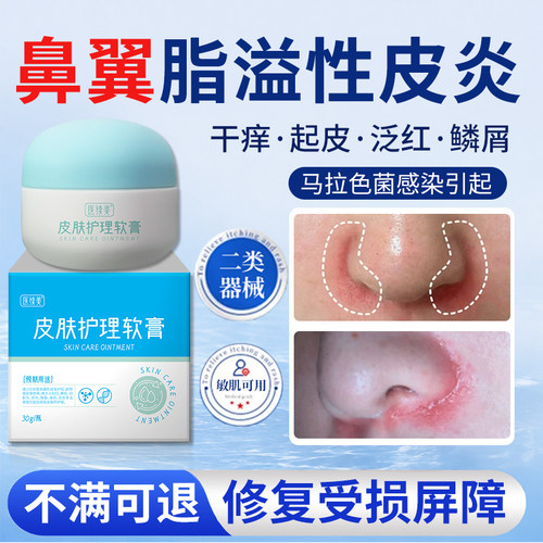 医续美脂溢性皮炎鼻翼两边泛红