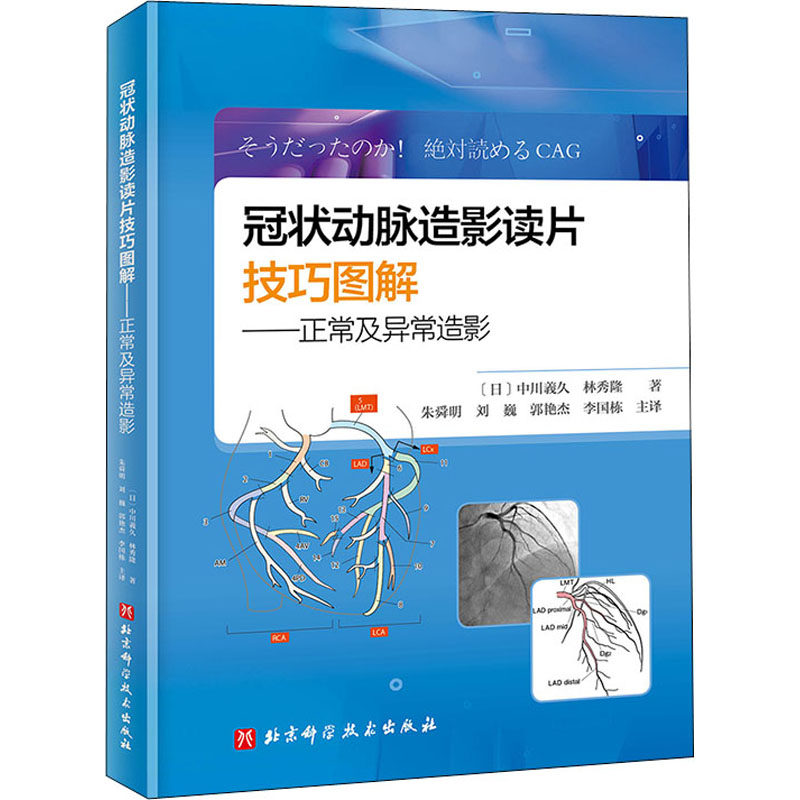 冠状动脉造影读片技巧图解——正常及异常造影 北京科学技术出版社 (日)中川义久,(日)林秀隆 著 朱舜明 等 译