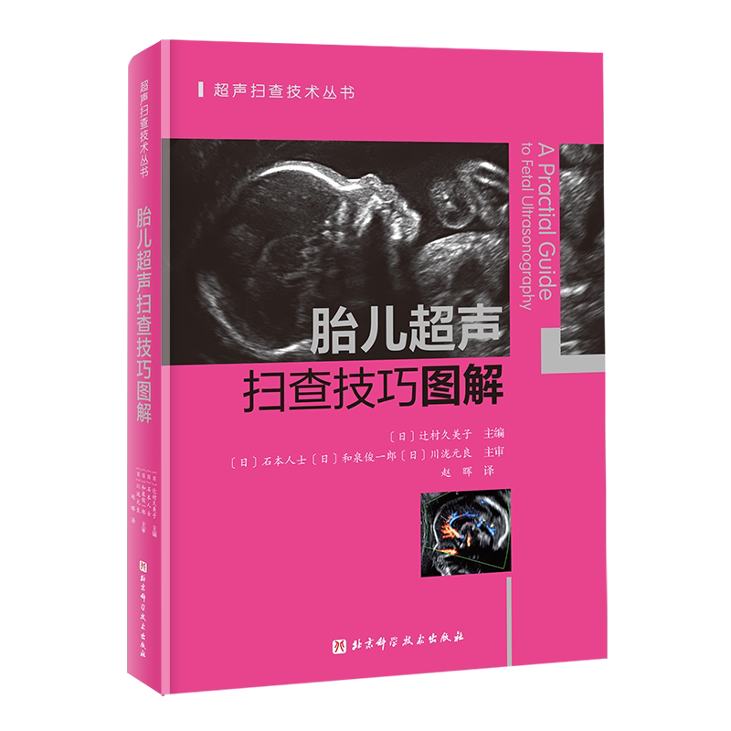 胎儿超声扫查技巧图解 北京科学技术出版社 (日)辻村久美子 编