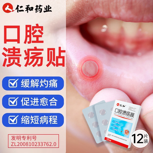 口腔溃疡贴儿童嘴巴上火舌头起泡烂专用贴