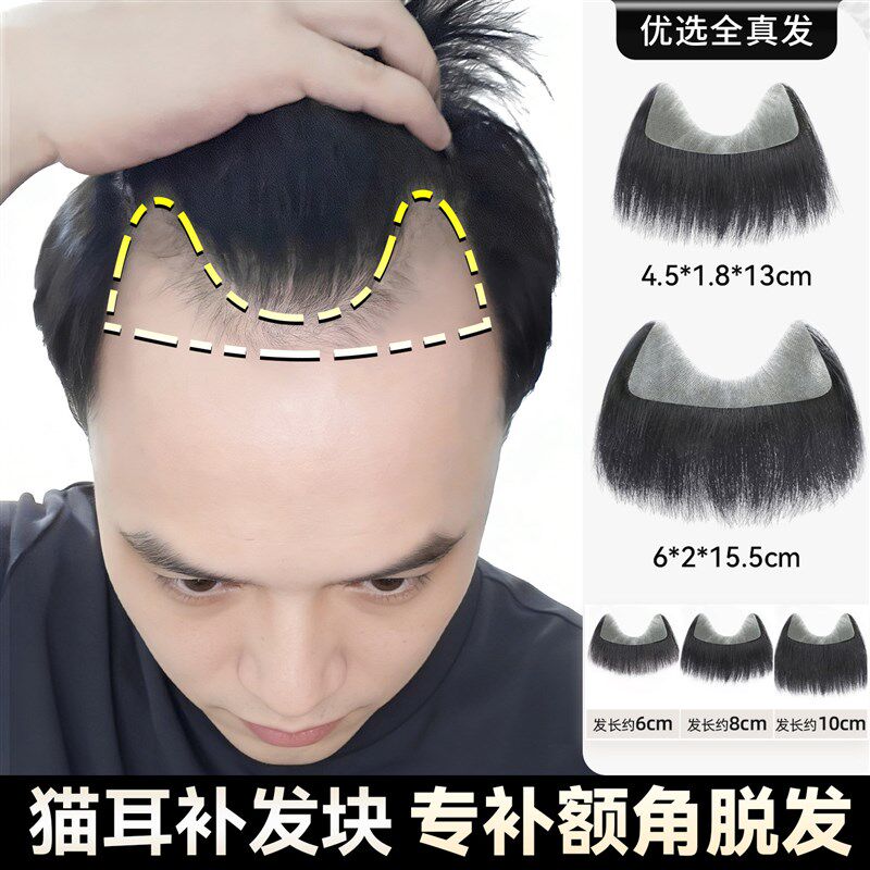 m型假发片男假刘海n增发量蓬松真发发际线假发贴自然前额刘海隐形