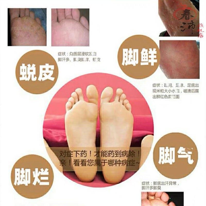 泰国杜玛秀脚气膏Dermaheu止痒脱皮烂脚丫原装杜马秀25g/15g