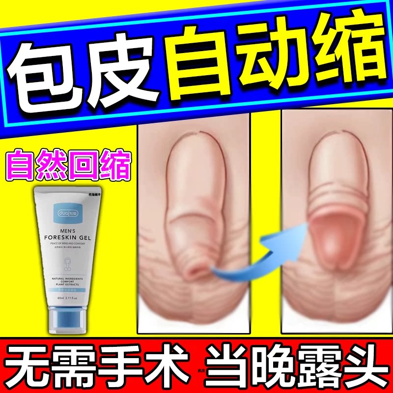 包皮过长修复收缩包皮过长切割器包茎口扩张无痛切割自动脱落神器