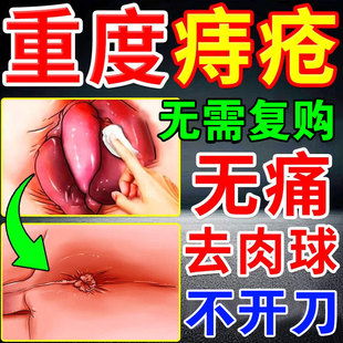 痔疮止血特专用效药大便出血断中药消肉球药膏根疗治的药内外混合