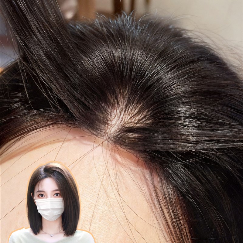 无需发卡魔术发缝贴假发r女片头顶自然前额蓬松高颅顶真发刘海补