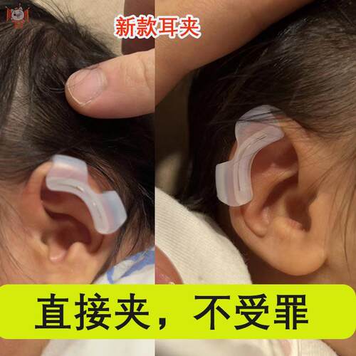 耳廓矫正器宝宝婴儿固定器新生儿硅胶矫形垂耳矫形器耳朵塑型定型