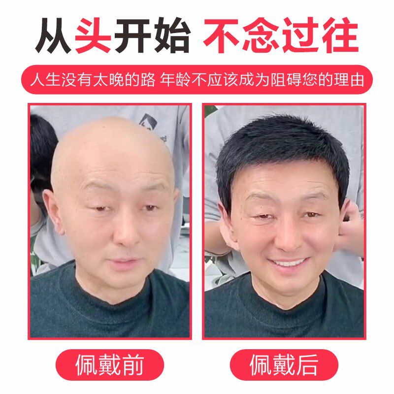 假发男许昌全头套式中老年短发遮盖白发光头真发逼真自然男士透气
