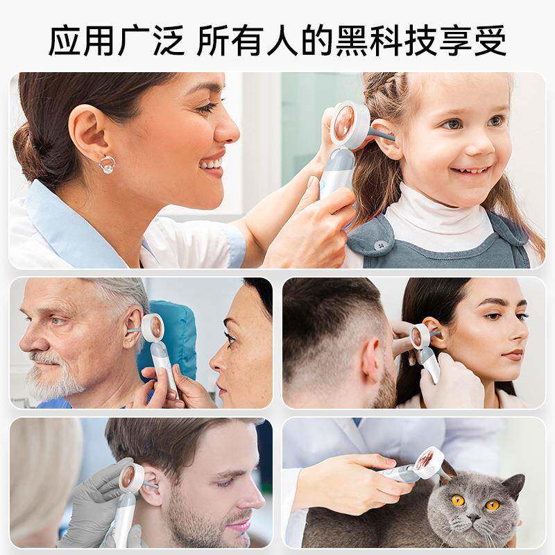 爆款发光耳道耳检Q10耳镜耳镜个护理能智可视镜窥耳仪耳人鼻喉检