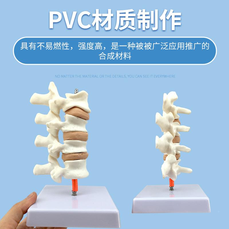 人骨质蔬松模型模脊典椎型病变模型体854脊椎模型骨质疏松具