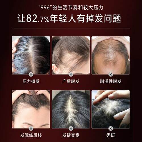 念【新概发】LLLT三光养发仪器红蓝光健发防落发护理生新生健7762
