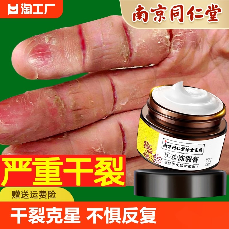 手指头裂干裂修复护手霜开裂脱皮手足皲I裂膏保湿手裂补水滋润手