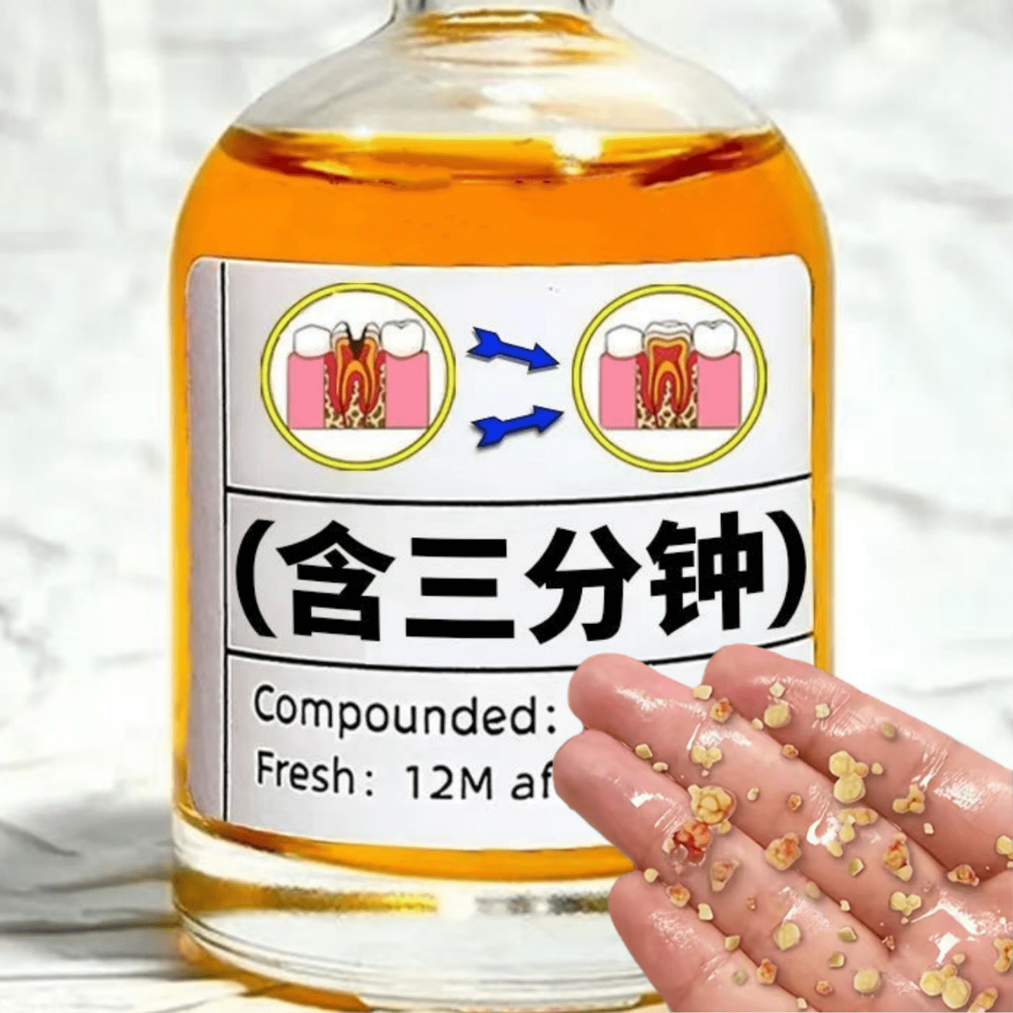 【日本断货王】牙石去除溶解漱口水洗牙污垢牙垢牙黄牙渍清理神器