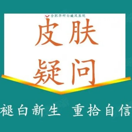 【皮肤疑问】白癜风|白斑（仅限初诊）