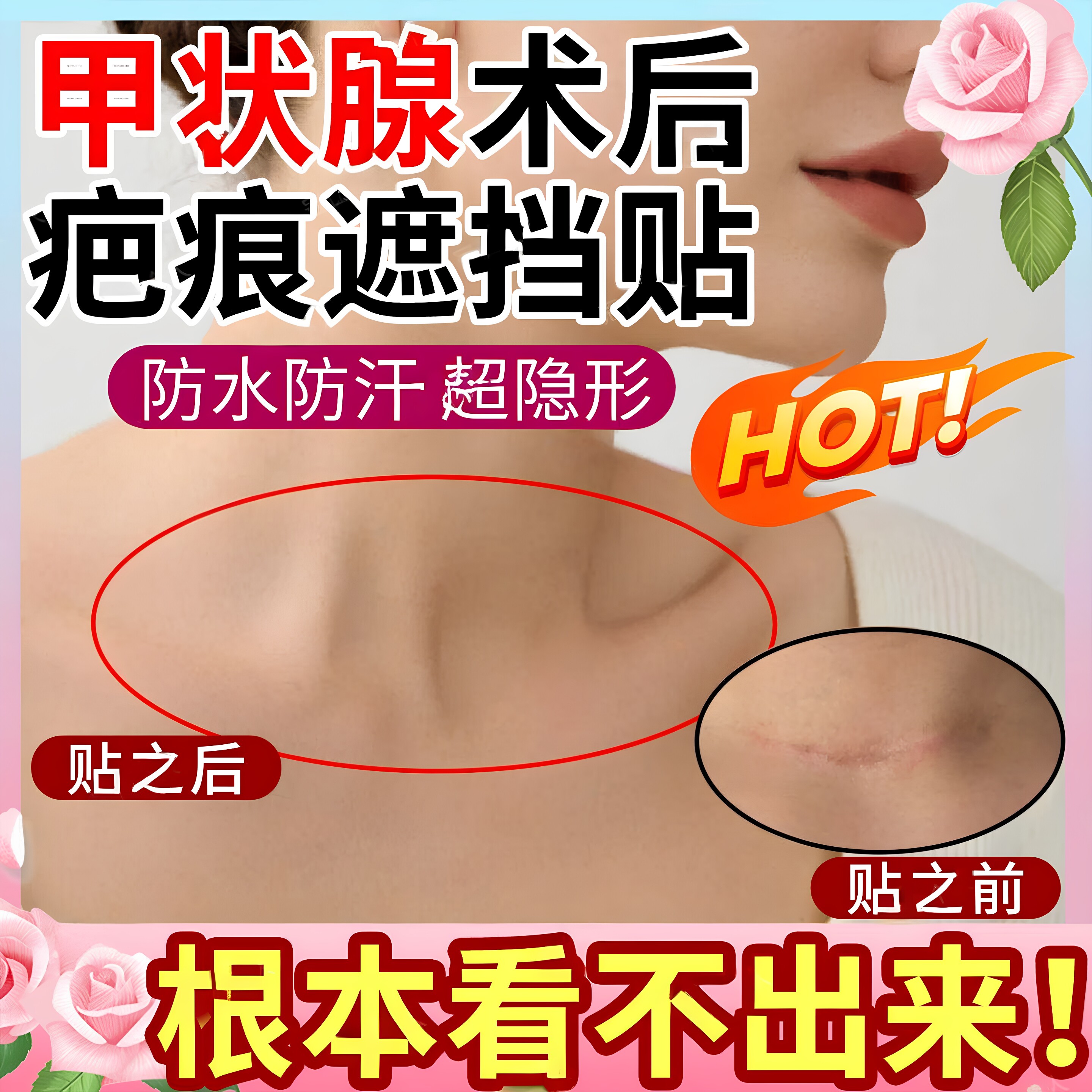 遮瑕膏纹身贴遮疤痕贴隐形遮盖神器肉色遮挡遮瑕胎记防水贴纸胶布