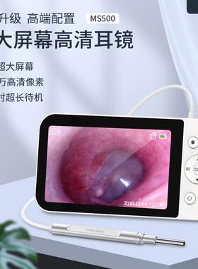 MS500高清5寸3.9mm 掏耳朵发光可视挖耳勺耳镜采耳工具耳道内视镜